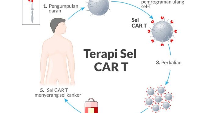 Terapi CAR-T: Inovasi Terbaru Dalam Pengobatan Kanker